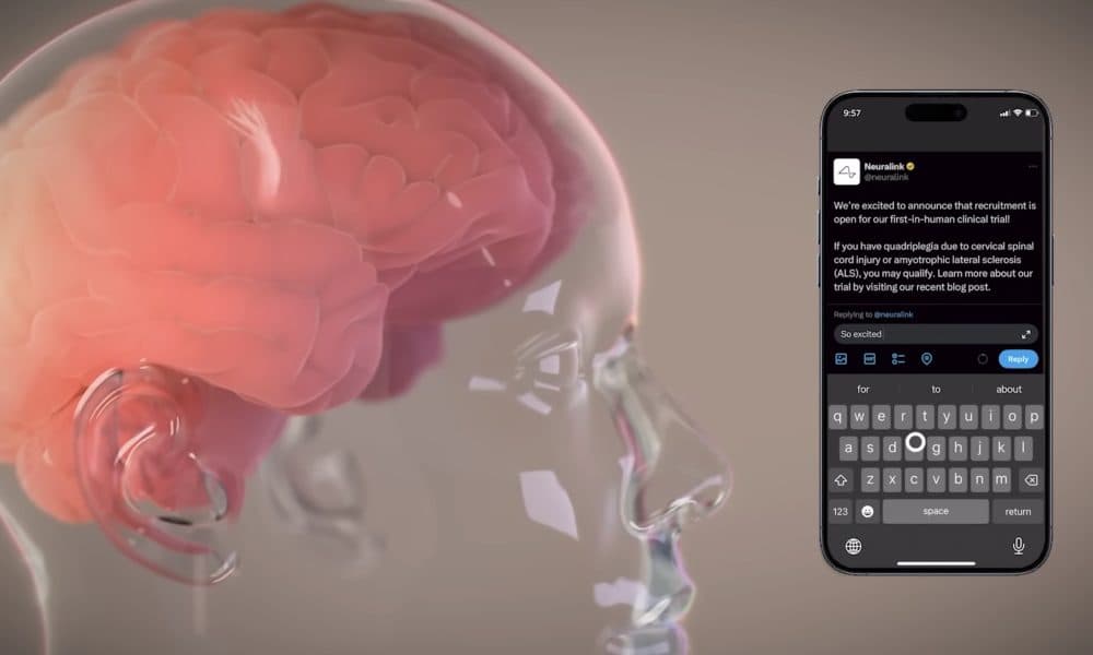 Neuralink étend son influence au Canada avec des implants cérébraux révolutionnaires en euros