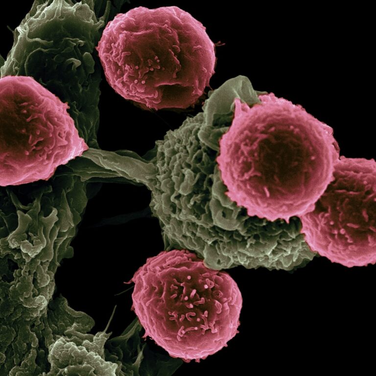 Cancer-Un-nouveau-traitement-efficace-contre-certains-cancers-en-phase-terminale