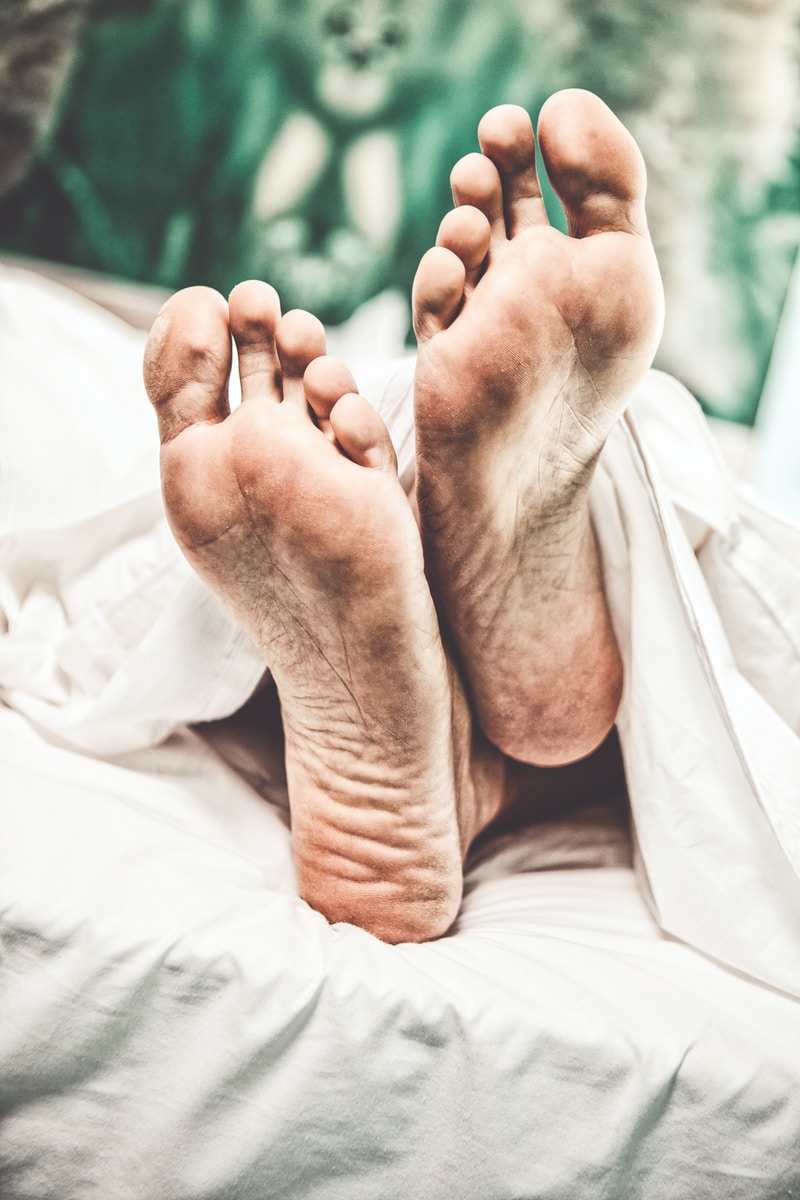 Crise de goutte comment prevenir eviter - Plare