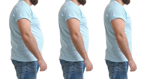 liposuccion homme