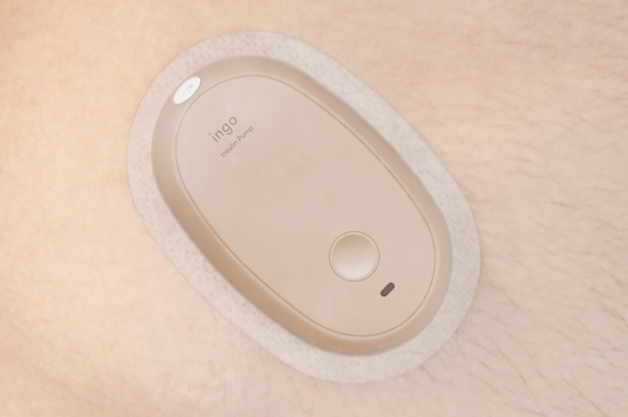 1714644696 252 Le concept de moniteur de glucose et de pompe a - plare.