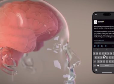 neuralink telepathy 1000x600 - plare.