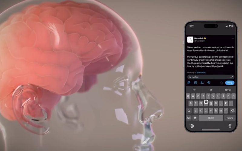 neuralink telepathy 1000x600 - plare.