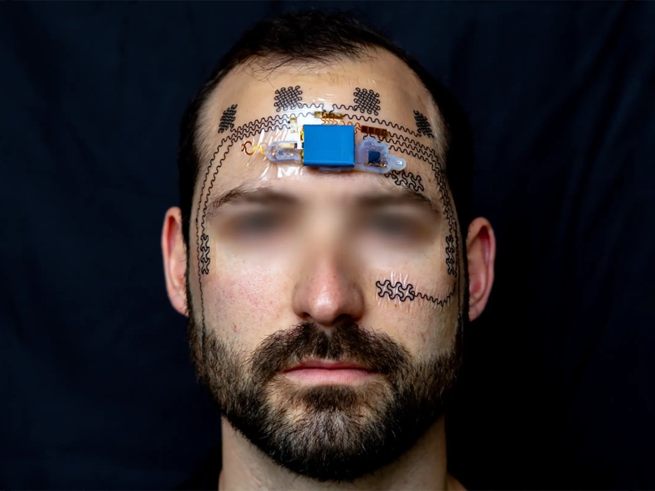 Decouvrez Comment les Tatouages Electroniques Revolutionnent le Suivi de Votre - plare.