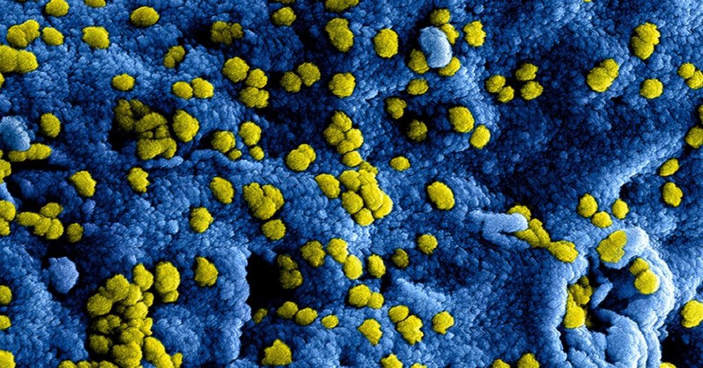 Nouvelles bactéries soulèvent des inquiétudes pour les efforts de protection planétaire. Nouvelles bactéries soulèvent des inquiétudes pour les efforts de protection planétaire.