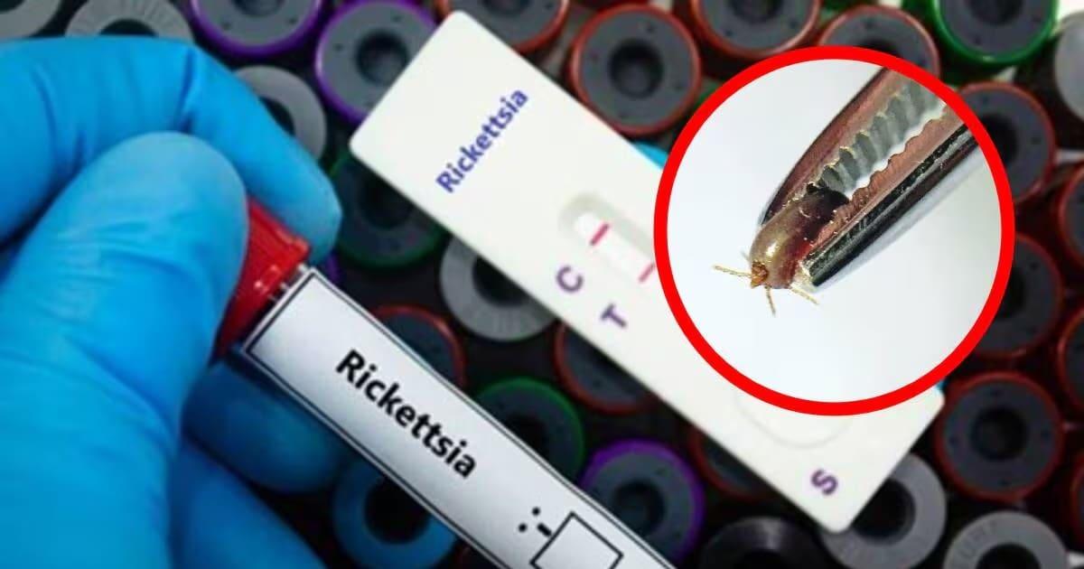 Image de prévention rickettsia