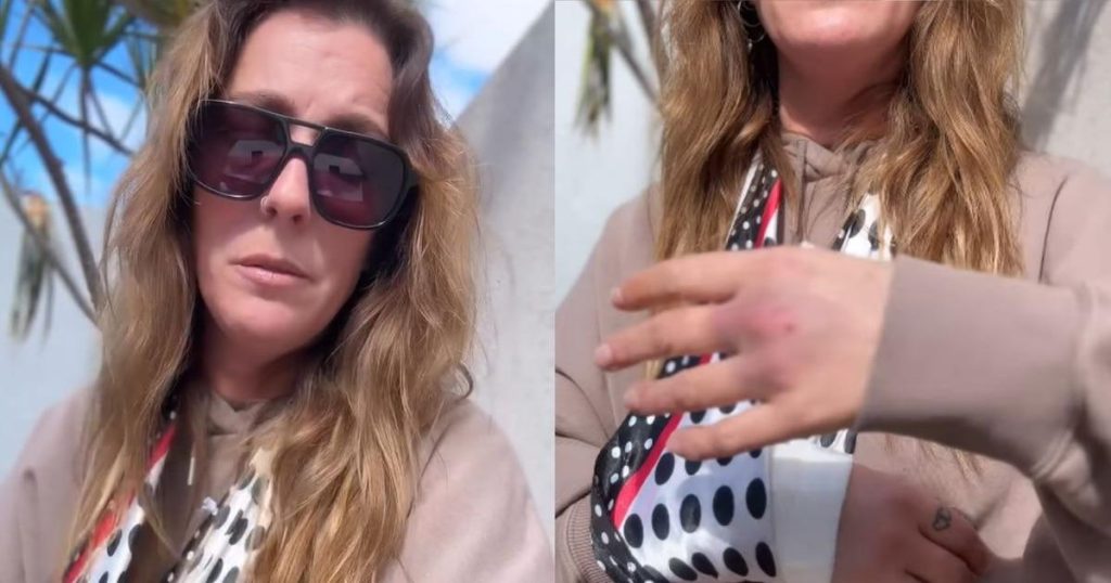 Dani La Chepi hospitalisée après un accident en tentant de séparer sa chienne d’une bagarre canine